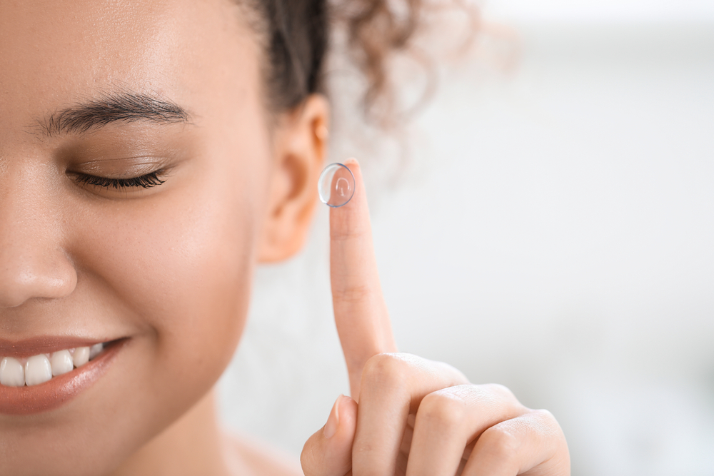 Treating Myopia with MiSight® Contact Lenses