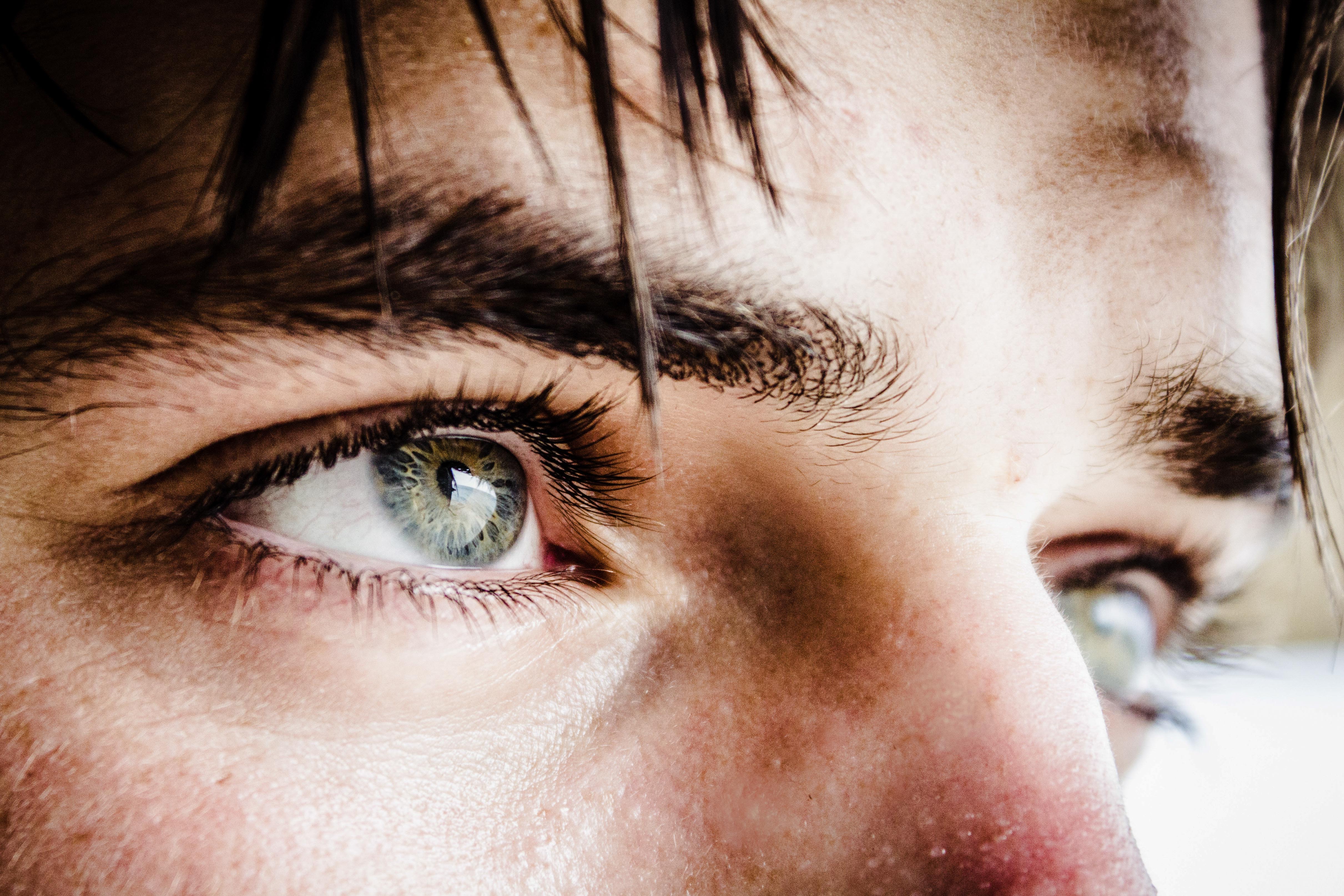 Dry Eye Syndrome Relief