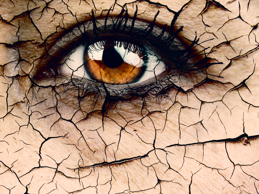 Effective Solutions for Dry Eye Relief in Auckland, NZ