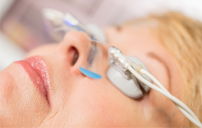 Is LipiFlow Treatment Right For My Dry Eyes?